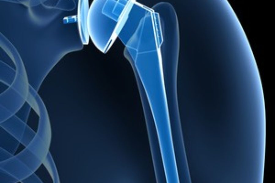 Ολική αρθροπλαστική ώμου-ισχίου-γόνατος
